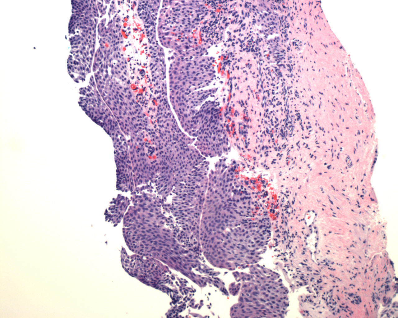Pathology Image